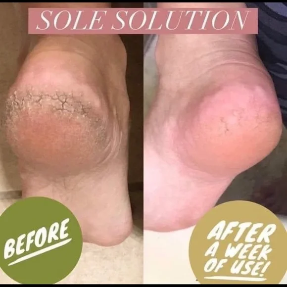 - (2) TWO Epoch NuSkin Sole Solution foot treatment